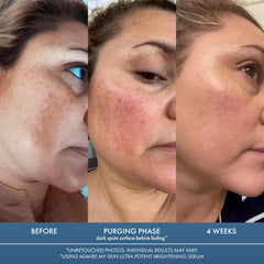 Textura ligera del serum de Admire My Skin para piel suave.