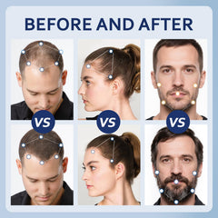 Artimore packaging box showcases 4 fl oz minoxidil kit.