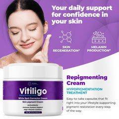 Aura Vitamins crema repigmentante – textura suave para aplicación diaria.