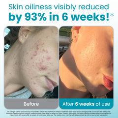 Toallas faciales desechables Clean Skin Club para uso individual, tamaño XL