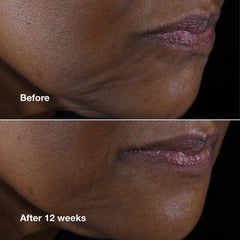 Clinique Smart Clinical Repair, aplicación suave en rostro para un tono uniforme.