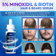 Gotero de DABIDA Minoxidil para aplicación precisa en el cuero cabelludo.
