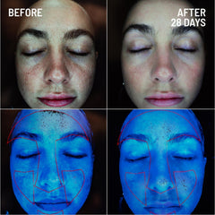 Dr Brandt Microdermabrasion, granulos biocelulosa para exfoliación segura