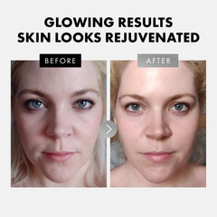 Eclat Skincare Ácido Hialurónico, gotas, mejora hidratación y firmeza.