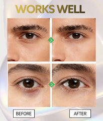 Elixbloom Retinol Niacinamida Antiaging: mejora firmeza y textura alrededor de ojos