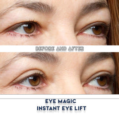 Eye Magic tiras de tamaño mediano para párpados caídos con fijación duradera