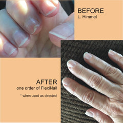 FlexiNail reparacion-uñas-debilitadas que favorece uñas más sanas con uso regular.
