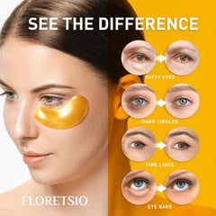 Parche Floretsio de adherencia estable para uso cómodo.