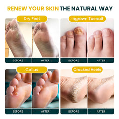 FOOT CURE fragancia arbol de te citrico en el baño