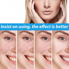 Fórmula suave para piel sensible, cuidado delicado del rostro.