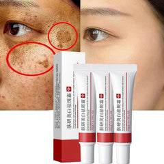 Generic crema para manchas en la cara, resultado semanal al suavizar el tono irregular.