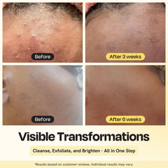 Gleamin limpiador con brillo y vitamina C para una tez más radiante.