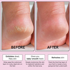 Grace & Stella Mascarilla Descamante en proceso de exfoliación suave