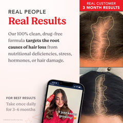 HAIRtamin Advanced Formula: pack de 3 meses, plan de cuidado capilar a largo plazo.