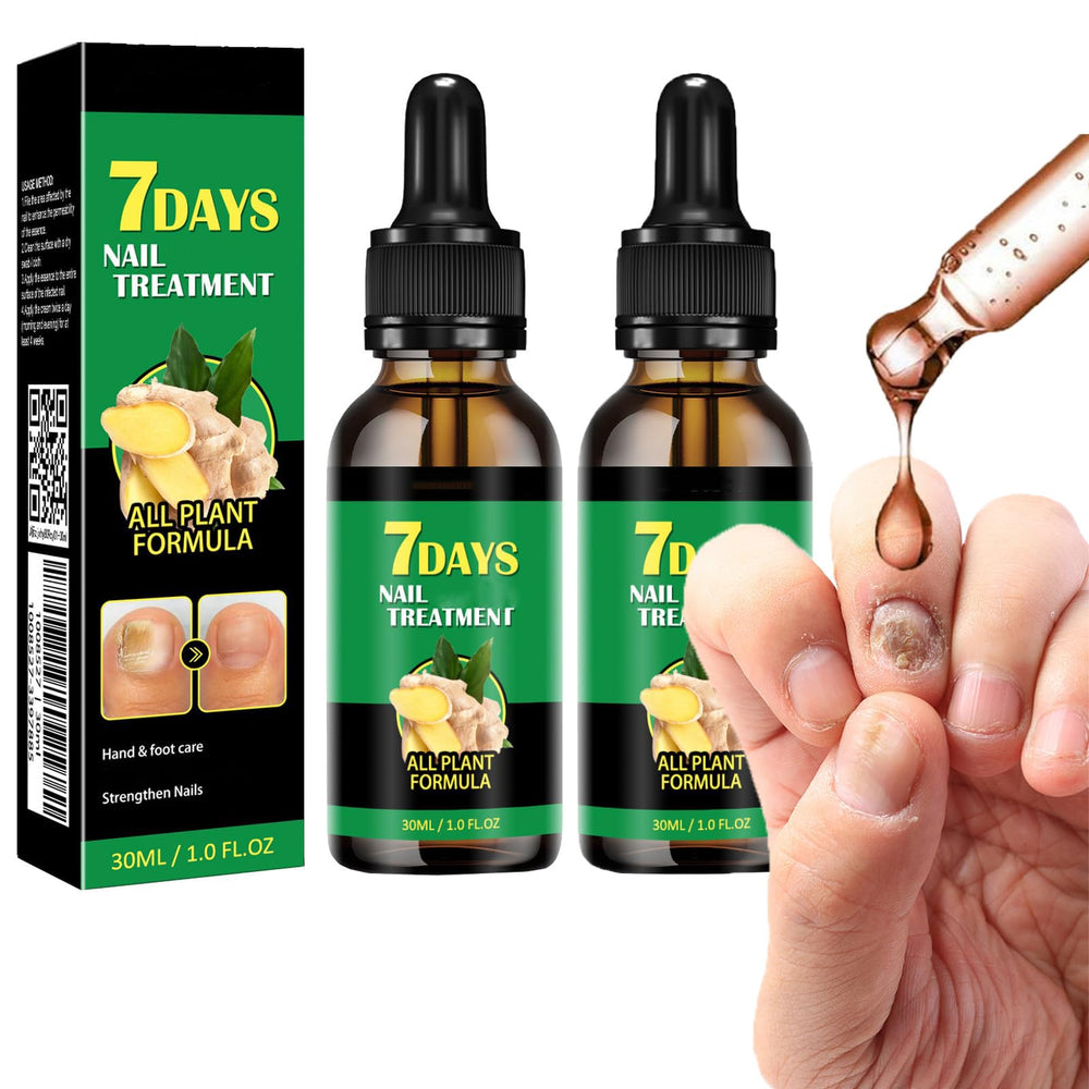 IMOLL Tratamiento de uñas con jengibre: bote de aceite para hidratación y fortalecimiento.
