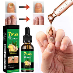 IMOLL Tratamiento de uñas con jengibre para fortalecer uñas débiles.