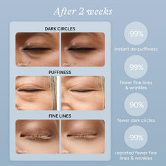 Parche de ojos In My Eyes con enfriamiento suave para deshinchar el contorno