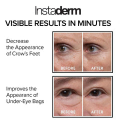 Instaderm bolsas-ojos-reduccion: posible alivio rápido