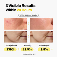 Ingrediente hialuronico en DermiShuttle para hidratacion profunda.