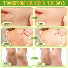 Laityum miel de manuka natural, nutrición suave para piel sensible.