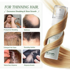 Morovan: para cabello fino, añade volumen y densidad con uso regular.