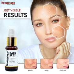 Neoprosone aplicación nocturna para manchas en rostro y cuello.