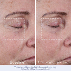 Obagi Elastiderm, primer plano de piel, revela firmeza suave y aspecto más joven.