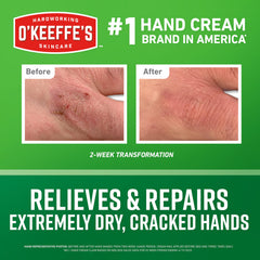 Crema para manos de O'Keeffe's para sequedad extrema: antes y después