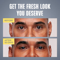 PENEBELLA crema ojos sin fragancia, adecuada para piel sensible.