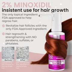 Rida Hair Research Institute aplicación en cuero cabelludo, cabello más denso posible con Minoxidil