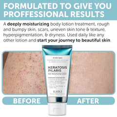 Rida: exfoliación suave para mejorar la textura de la piel.