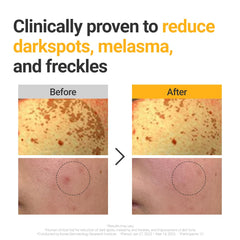 ROVECTIN Vita Dark Spot Serum con extracto de espino amarillo para brillo saludable.