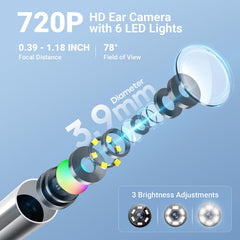 ScopeAround imágenes nítidas 720p para ver detalles del canal auditivo.