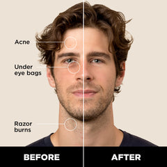 Stryx corrector para caballero, tono caoba mediano, oculta acné sin dejar residuo.