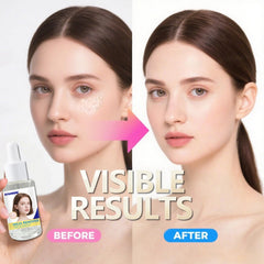Uso en ojos: Sylvirene Milia Remover Serum trata zonas delicadas con suavidad.