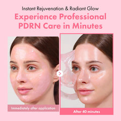 TOSOWOONG Real Pink PDRN Fit: mascarilla en secado con comodidad y textura suave