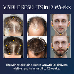 Venanoci cabello y barba más densos con uso continuo.