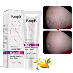 YG LianKai Mango Cream, enfoque en bote, ayuda a hidratar y suavizar estrías.