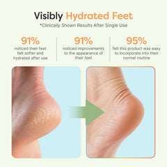 ZenToes talones infusionados con jojoba, oliva y vitamina E para hidratación