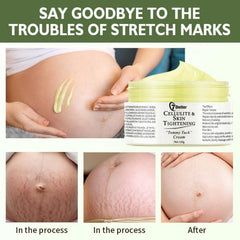 Crema 7better para firmeza del abdomen, ayuda a piel más elástica