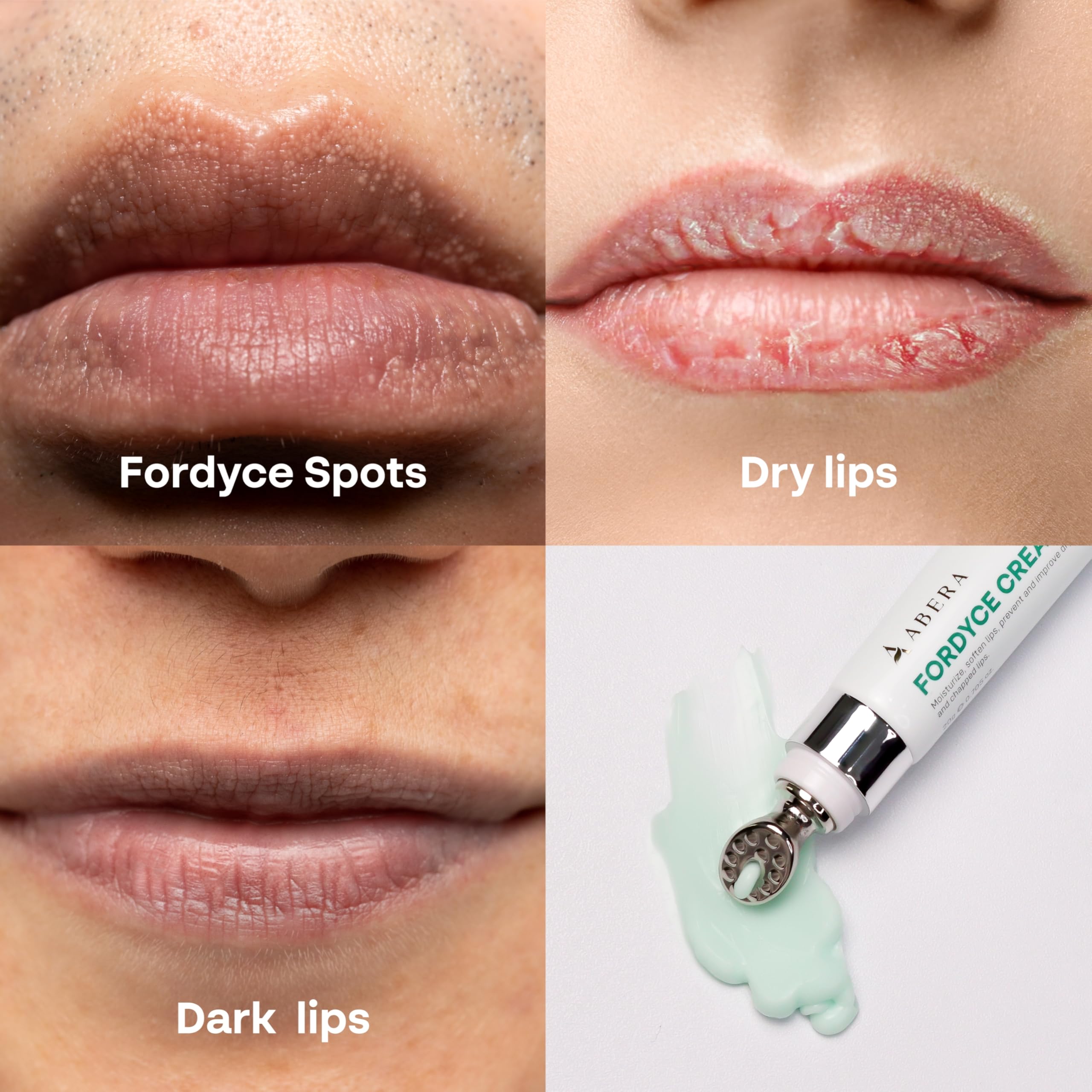 Uso diario con ABERA Fordyce Cream para labios hidratados
