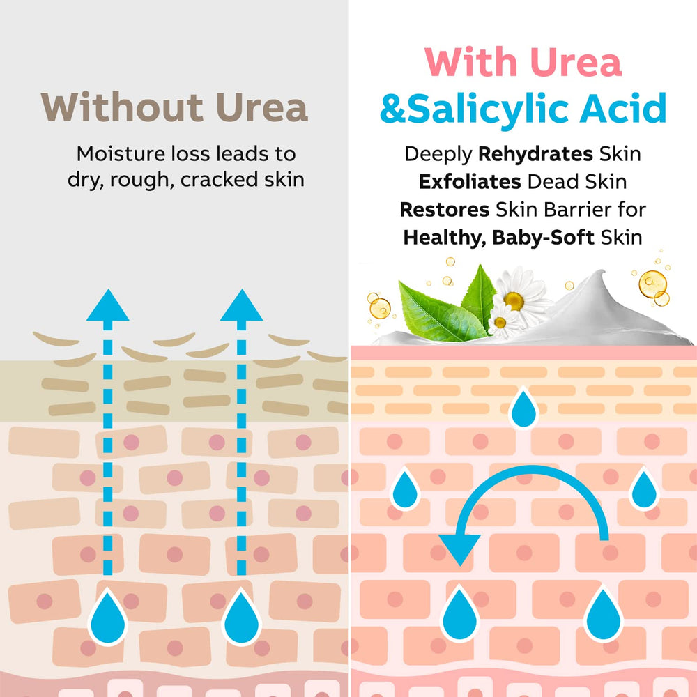 Aplicación de Adellina Urea 40% para una piel más suave.