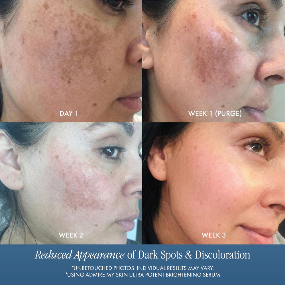 Aplicación en rostro con la mano usando el serum Admire My Skin.