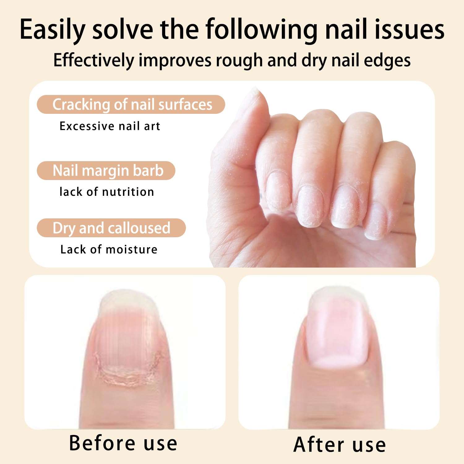 AIJIMEI hidratación de uñas alrededor de cutículas, ideal tras manicura.