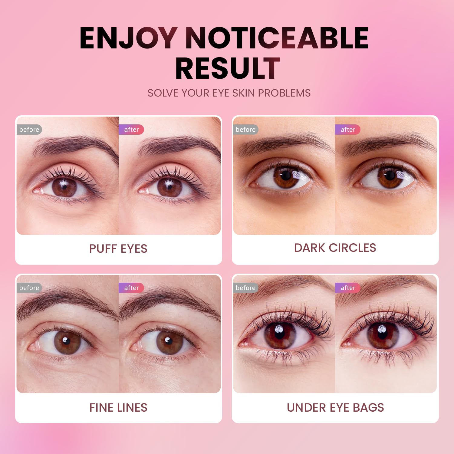 Parches ojos AILEORY textura gel suave para uso diario.