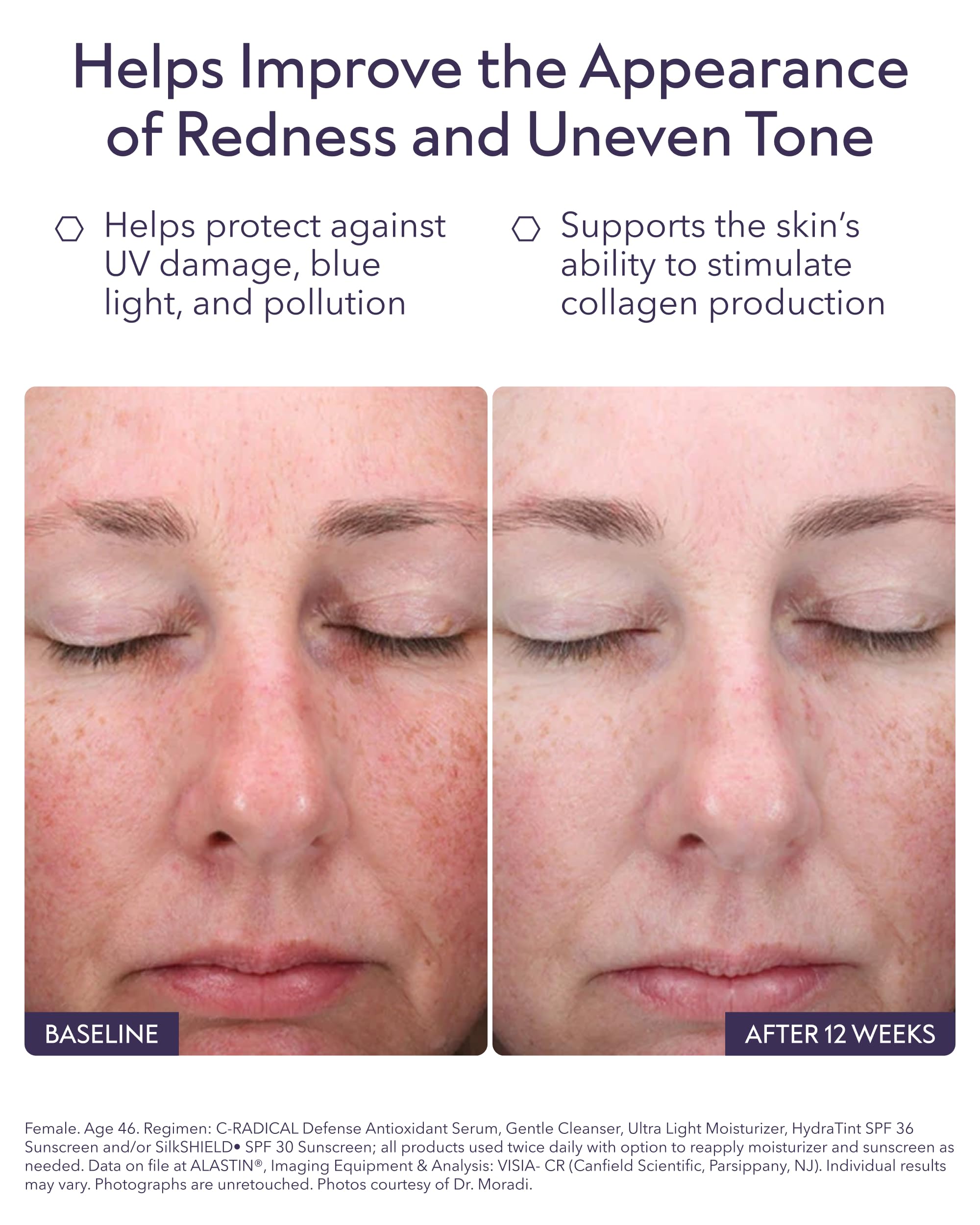 ALASTIN C-RADICAL Defense Serum, gotero para aplicaciones precisas.