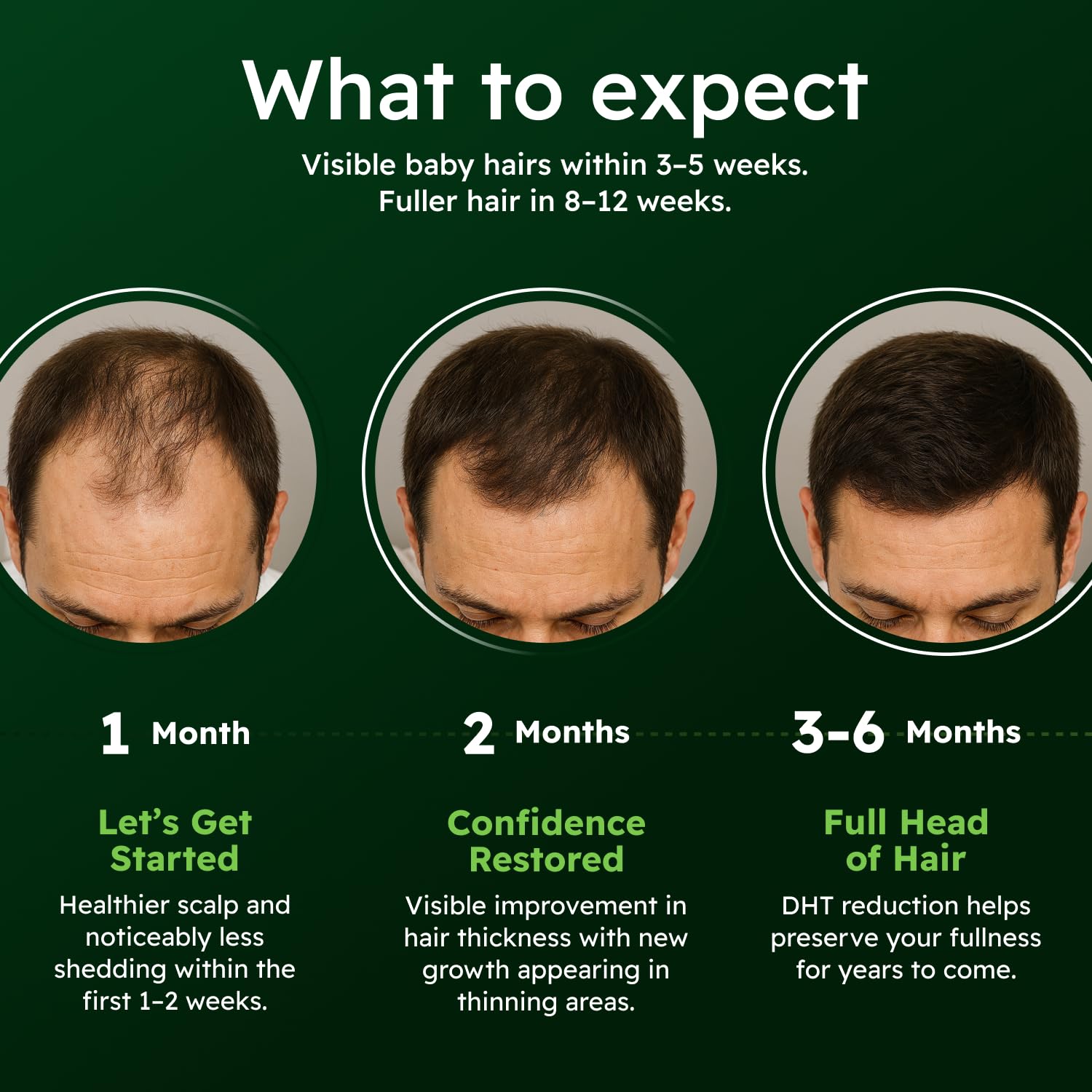 Alphainfuse Serum cuero cabelludo hidratado y cómodo gracias a su fórmula.