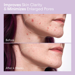 Alpyn Beauty Extracto de Borraja, ingredientes clave para calmar la piel.