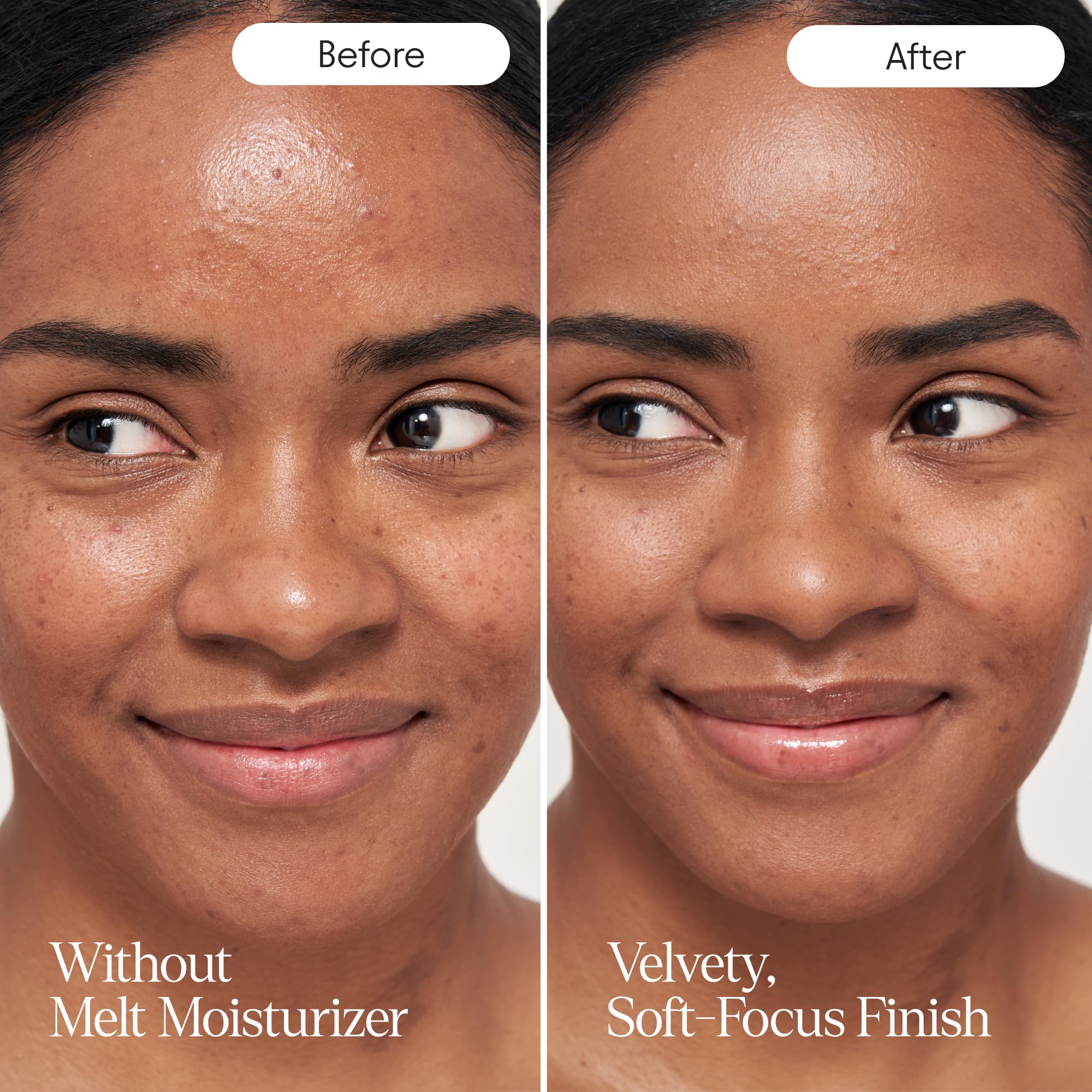 ALPYN Melt Moisturizer con ácido hialurónico para hidratación duradera.