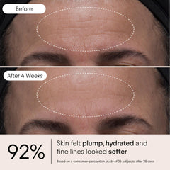 ALPYN Melt Moisturizer con bakuchiol para suavizar la apariencia de líneas.